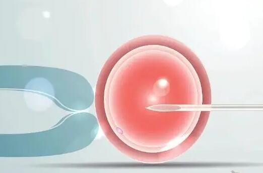 泰国试管婴儿技术如何啊为什么能够筛选胎儿性别